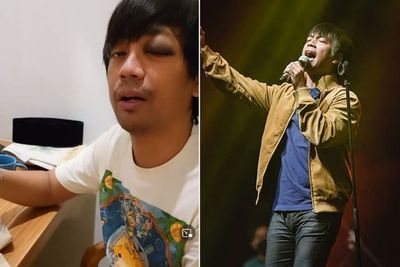 Alami Kecelakaan, D Masiv Maksain Tampil dan Hibur Penggemar di Banyuwangi!