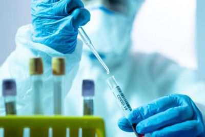 Untuk Pertama Kalinya, Peneliti Sengaja Masukkan Virus COVID-19 ke Manusia, Apa Hasilnya?