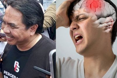 Dialami Ade Armando, Pendarahan Otak Ternyata Bisa Sebabkan Cacat Fisik dan Mental