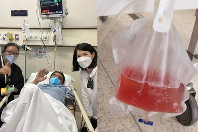 Ade Armando Kini Alami Pendarahan Kandung Kemih, Apa Gejala & Resikonya Mengkhawatirkan?