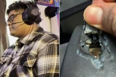 Nyaris Tewas, Remaja Ini Selamat dari Peluru Nyasar Berkat Headset