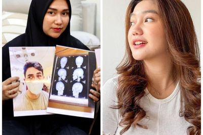 Istri Putra Siregar Ungkap Foto Visum Rico Valentino, Chika Jadi Gunjingan: Liat Ulah Lo!