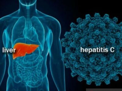 3 Pasien Hepatitis Akut Meninggal Menyerang Anak Secara Misterius, Berikut Ini Gejalanya