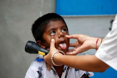 Fakta-Fakta Hepatitis Akut dan Alasan Disebut Misterius