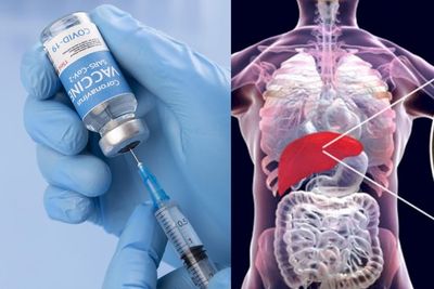 Dokter Sebut Vaksin COVID-19 Belum Dapat Dipastikan Jadi Penyebab Hepatitis Misterius