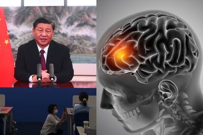 Diidap Presiden China Xi Jinping, Berikut yang Harus Diketahui Mengenai Aneurisma Otak