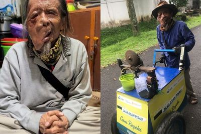 Perjuangan Pak Engkos Pengidap Tumor Ini Bikin Pilu: Bapak Mah Tinggal Nunggu Umur
