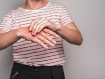 Penyebab Asam Urat Tinggi dan Cara Mencegahnya, Perhatikan Gaya Hidup
