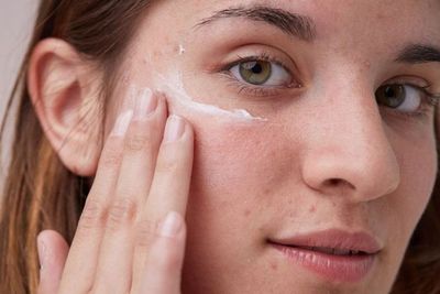 Mudah dan Praktis, Ini 3 Cara Hilangkan Bekas Jerawat dengan Bahan Sederhana!