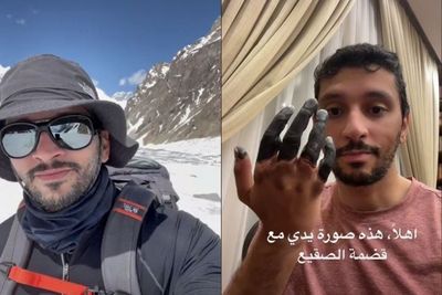 Hobi Mendaki Gunung, Pria Arab ini Alami Frostbite , Jari Tangan Terpaksa Diamputasi