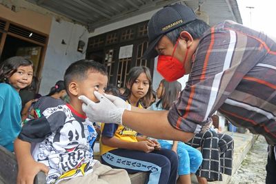 Hepatitis Akut Berujung Kematian Anak, Kata Kemenkes Ada Virus Tunggu Kajian dari WHO