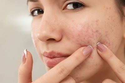 Kulit Tetap Bermasalah? Ini 4 Alasan Skincare Kamu Gak Mempan