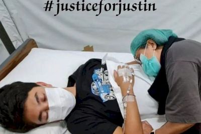 Kondisi Terkini Justin Frederick Usai Dipukuli: Muntah-muntah hingga Rahang Memar