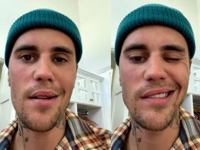 Justin Bieber Posting Foto Nangis, Fans Khawatir Tentang Kesehatannya