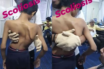 Viral, Pria ini Sembuhkan Tulang Bengkok Hanya dengan Tangan Kosong, Warganet Ikut Ngilu!