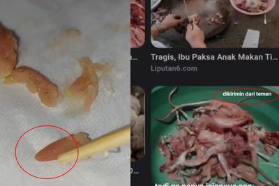 Viral, Cewek Curhat Nemu Daging Aneh di dalam Dimsum, Warganet Kaitkan dengan Bakso Tikus