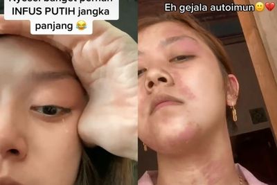 Viral, Wanita Curhat Nyesal Suntik Putih, Bikin Sesak Nafas hingga Mudah Lelah