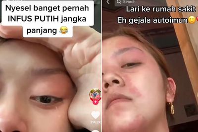 Ngeri! Wanita Ini Suntik Putih hingga Alami Ruam Sekujur Tubuh, Netizen: Mending Facial