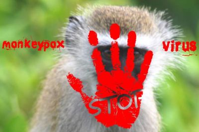 Ditetapkan WHN Sebagai Pandemi, Cacar Monyet Bisa Menular Lewat Handuk dan Tempat Tidur