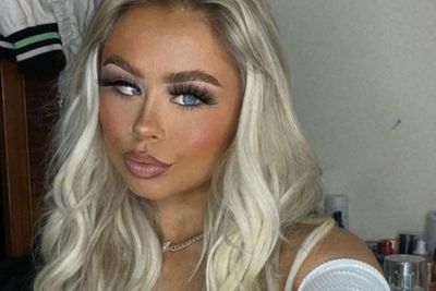 Lawan Bully, Wanita Kondisi Mata Malas Jadi Model OnlyFans, Kini Jadi Seleb Tiktok