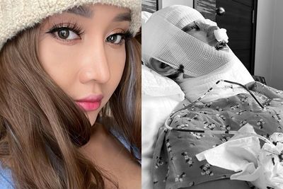 Lucinta Luna Operasi Wajah Lagi demi Jadi Ratu 9 Nyawa: Ya Ampun, Mau Cantik Sakit Amat