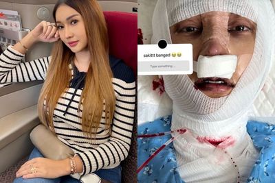 Lucinta Luna Operasi Pemotongan Leher, Ganti Suara Cowok Jadi Suara Kucing