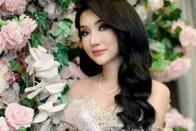 Ngilu! Potong Leher demi Hilangkan Khodam, Ini Potret Lucinta Luna Usai Oplas