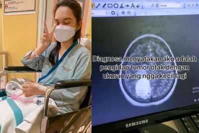 Curhat Gadis Muda Kena Tumor Otak, Sempat Dikira Salah Bantal karena Pusing & Sakit Leher
