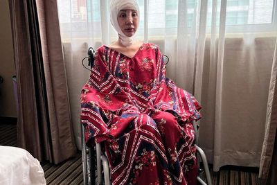 Usai Operasi Potong Leher, Lucinta Luna Kembali Jalani Operasi Tulang Ekor, Ini Risikonya!