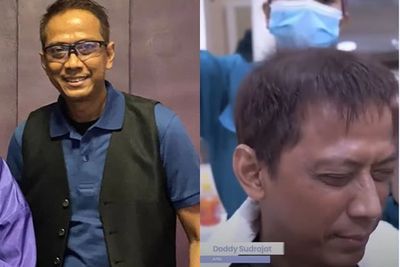 Doddy Sudrajat Dinyinyiri Sibuk Perawatan Rambut Hempas Kebotakan: Suntik Pengisian Otak?