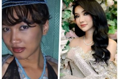 Viral Video Before-After Oplas Lucinta Luna, Netizen Ribut Pertanyakan Asal Duitnya