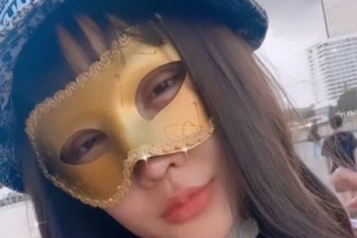 Perubahan Wajah Lucinta Luna Usai Oplas Besar-besaran, Matanya Beler, Jakun Diperban