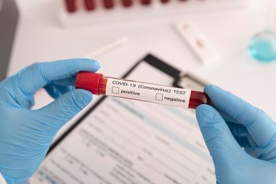 Hampir Sama! Ini Perbedaan Gejala COVID-19 dan Flu Biasa agar Tidak Salah