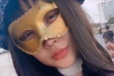 Lucinta Luna Buang Jakun Dibantu Dokter Korea, Intip Potretnya 