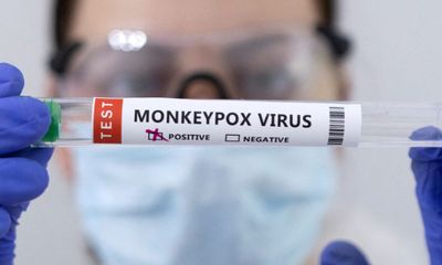 Heboh Suspek Cacar Monyet di Jateng, Yuk Kenali Kelompok Rentan Terinfeksi Monkeypox