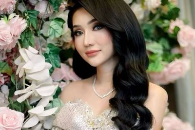 Lucinta Luna Pamer Wajah Bengkak-bengkak Usai Oplas: Cantikan yang Dulu