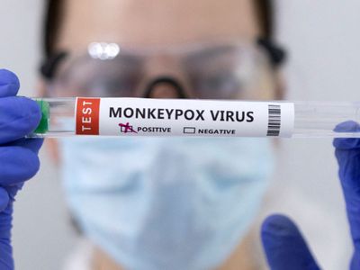 Upaya Pemerintah Atasi Cacar Monyet: Gaet Komunitas Lelaki Suka Lelaki hingga Vaksinasi