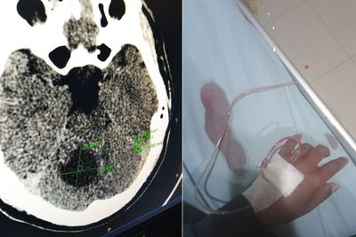 Cuitan Pilu Pasien Tumor Otak di Twitter, Minta Izin Tutup Akun: Umur Gak Lama Lagi