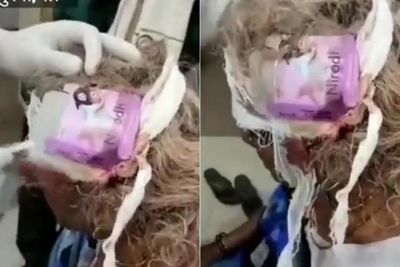 Astaga, Petugas Medis Tutupi Luka Wanita Tua Menggunakan Bungkus Kondom