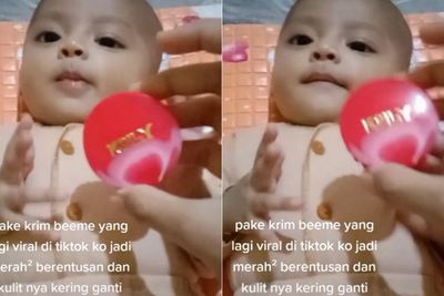 Heboh Video Ibu Aplikasikan Krim Kelly pada Bayinya, Begini Penjelasan Dokter