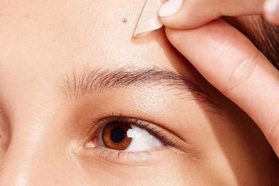 Acne Patch Solusi Cepat Hilangkan Jerawat dalam Semalam, Masa Sih?