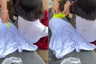 Viral Guru Bantu Murid Bersihkan Ratusan Kutu, Ternyata Ini Lho Bahayanya pada Kesehatan