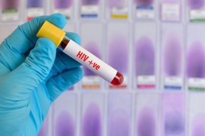 Soal 414 Kasus HIV di Bandung yang Gegerkan Masyarakat Ternyata Akumulasi Selama 30 Tahun