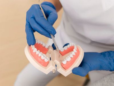 Mengenal Maloklusi Pada Anak: Penyebab, Risiko, hingga Cara Mencegahnya