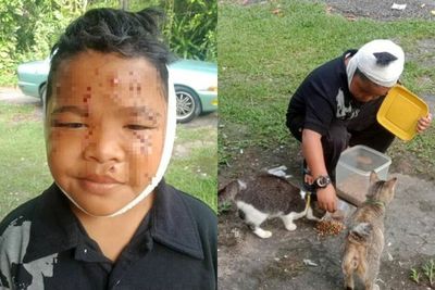 Salut, Bocah Ini Tetap Sayang Kucing Meski Wajahnya Penuh Luka Cakaran Setiap Hari