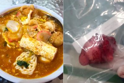 Viral Cewek Makan Seblak hingga Mie Ayam Hampir Setiap Hari, Berujung Operasi Tumor