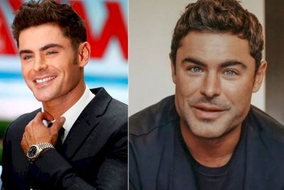 Bentuk Wajah Aktor Zac Efron Berubah, Dagunya Goyang karena Hantam Granit