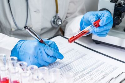 Soroti Perilaku Seksual Beresiko, Surabaya Didominasi Usia Pekerja Jadi Penderita HIV AIDS