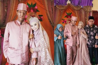 Kabar Bahagia! Surya Manurung Pria Pengidap Sindrom Langka Menikah, Istrinya Gadis Cantik