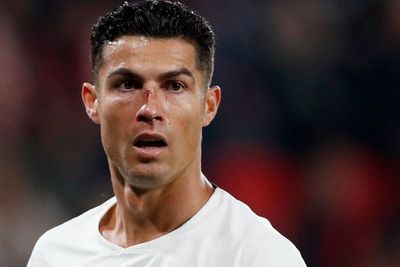 Ronaldo Umur 37 Masih Ambisius Cetak Gol, Kejar Bola hingga Hidung Berdarah